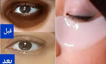 مفيش سواد تحت عينك من الآن.. حطي هذا الخليط ربع ساعه تحت العين والنتيجة ستبهرك