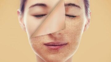 133 141239 moisturize dry skin 700x400