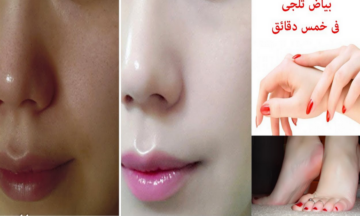 لو عند مناسبة قريب.. 3 ماسكات لتفتيح البشرة السريع وإزالة أثار الحبوب والبقع الداكنة وكوني “شمعه منورة”