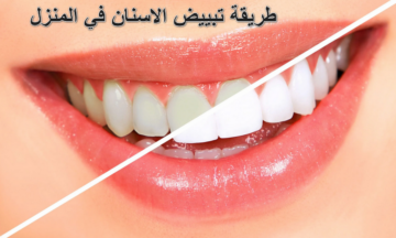 هيبقو زي اللؤلؤ.. حيلة جديدة لتبييض الأسنان بالمنزل في 5 دقائق بس موش هتخطر على بالك