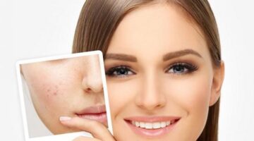 47 132815 benefits of cocoa butter for skin 700x400