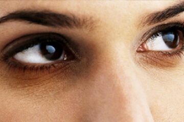 طريقة استخدام الزيوت الطبيعية للتخلص من الهالات وكيفية التخلص منها
