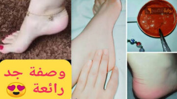 كعبك هينور زي الأطفال.. خلطة البيكنج بودر والليمون هتقضي علي تشقق الكعبين والخشونة في دقائق هتورد من اول استعمال هتبقي زي الحرير