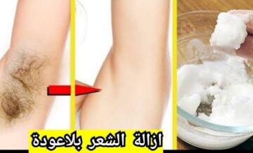 طرق طبيعية بدون ألم لإزالة الشعر الزائد والنتيجة مبهرة