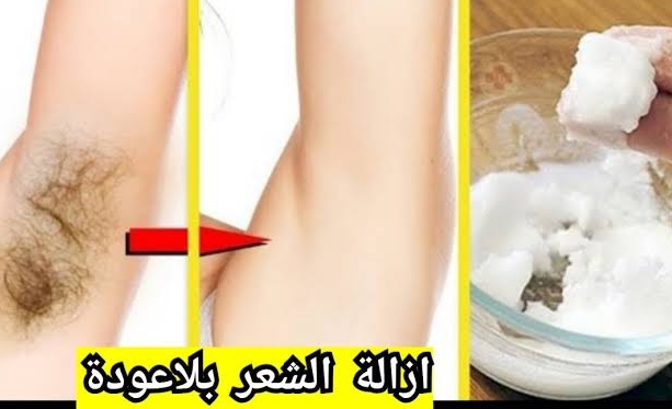 طرق طبيعية بدون ألم لإزالة الشعر الزائد والنتيجة مبهرة 5 طرق طبيعية بدون ألم لإزالة الشعر الزائد والنتيجة مبهرة