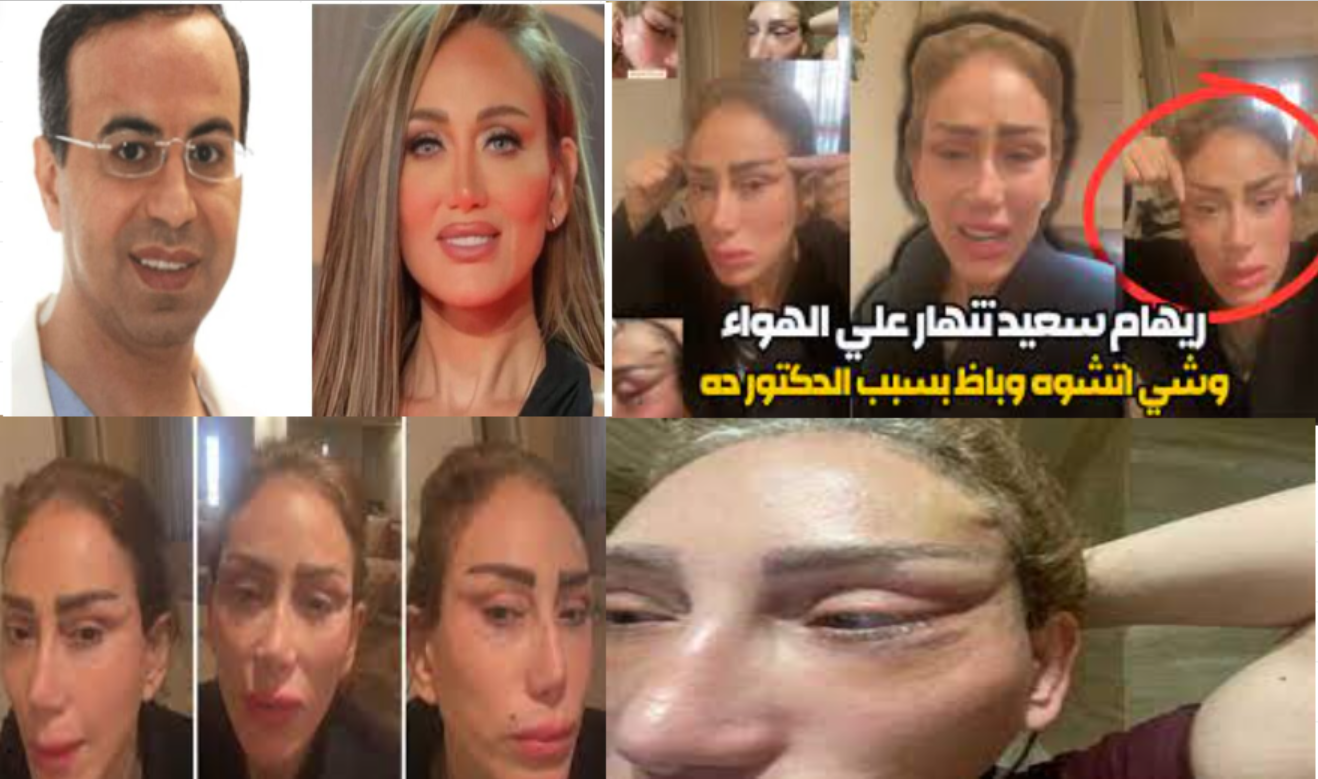 بعد تشوهه وجها ريهام سعيد تتهم دكتور التجميل وتوجه له انتقادات لاذعة علي الهواء مباشر 5 بعد تشوهه وجها ريهام سعيد تتهم دكتور التجميل وتوجه له انتقادات لاذعة علي الهواء مباشر