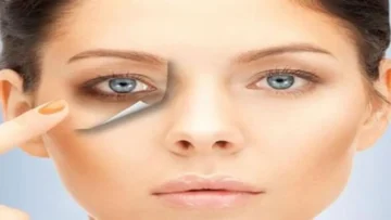 الهالات السوداء مشكلة كبيرة ومزعجة تخلصي منها بأقوى الوصفات الطبيعية السريعة والنتيجة مذهلة