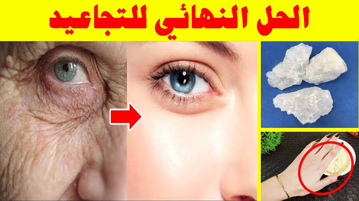 عودي لشبابك.. أقوى الوصفات رائعة للتخلص من التجاعيد وعلامات التقدم في العمر في دقائق معدودة!