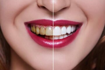 بطريقة صحية وسريعة.. أفضل وصفات تبييض الأسنان من الاصفرار بنسبة 100%.. ابتسامتك هتنور!