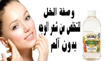 أسرع طريقة إزالة الشعر الزائد بالخل نهائياً أسهل وبدون ألك
