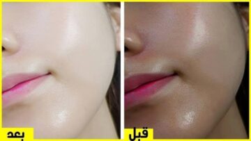 نورك هيزغلل العيون.. وصفة جبارة بمكونات طبيعية لتفتيح البشرة 5 درجات في ثواني