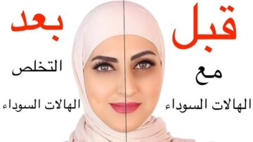 هترجعي نص جمالك.. وصفات سحرية للتخلص من الهالات السوداء حول العين تماماً