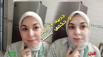 imططسسطكages 1