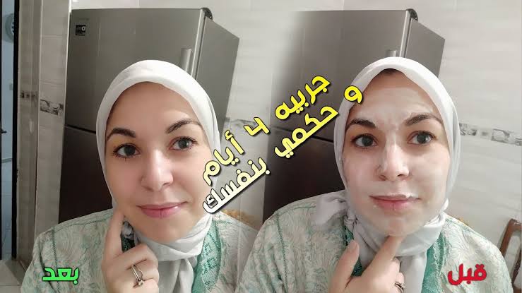 هتصغري عشرين سنة.. كولاجين البطاطس الرهيب لتبييض الوجه والجسم كله وإزالة سواد السنين والجلد الميت في ثواني هتنوري
