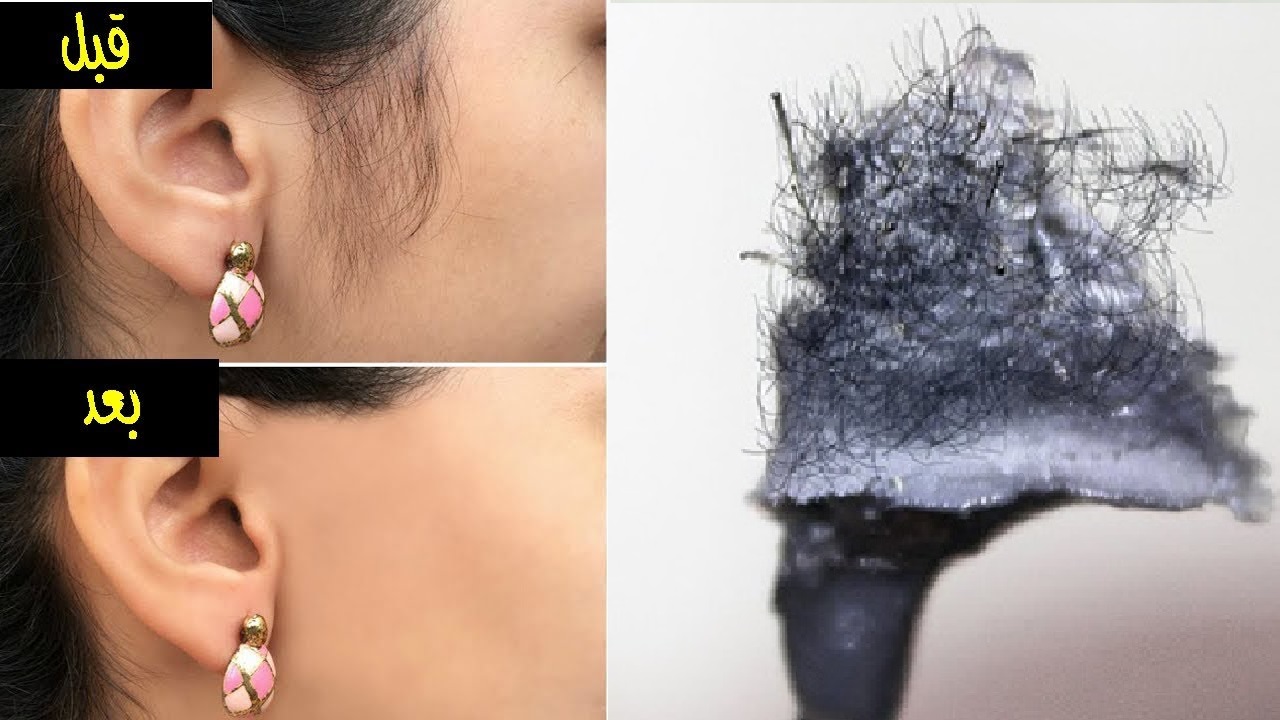 ارخص من الليزر ازالة شعر الوجه وفوق الشفايف والجسم يتساقط في ثواني بدون الم بطريقة طبيعية 5 ارخص من الليزر ازالة شعر الوجه وفوق الشفايف والجسم يتساقط في ثواني بدون الم بطريقة طبيعية