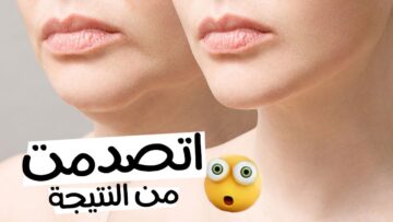 سيروم لشد الوجه من صنع ايديك اوعى تاني تشتريه نتيجته من أول أسبوع