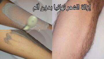 بديل الليزر.. سر رماد الفحم لإزالة شعر الوجه والمناطق الحساسة بدون ألم نهائيا في ثواني وتبيض فوري