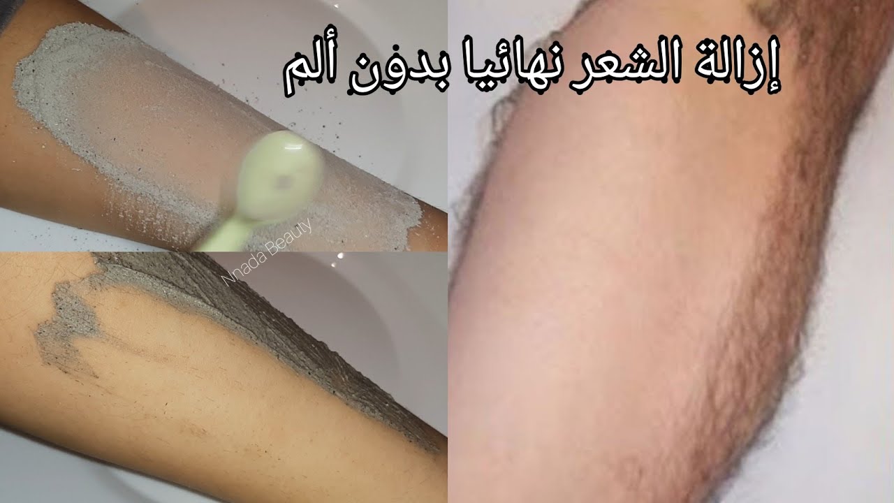 بديل الليزر.. سر رماد الفحم لإزالة شعر الوجه والمناطق الحساسة بدون ألم نهائيا في ثواني وتبيض فوري