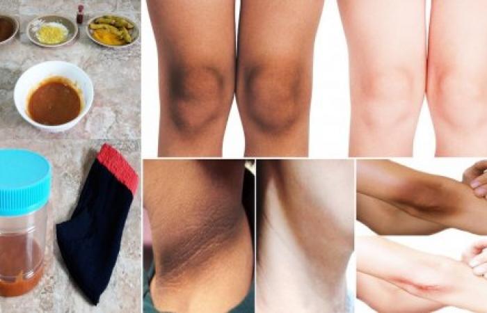 مقشر سحري لأي عروسة هيزيل سواد السنين من الركب والاكواع وهيخليهم زي القشطة 5 مقشر سحري لأي عروسة هيزيل سواد السنين من الركب والاكواع وهيخليهم زي القشطة