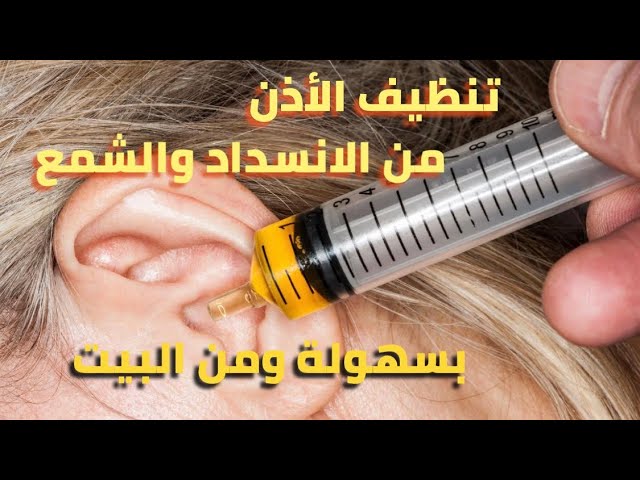 طريقة سحرية لتنظيف الأذن من الشمع في المنزل ببساطه وبأمان وبدون ألم