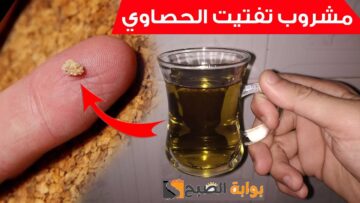 أفضل مشروب يساعد في تفتيت حصى الكلى ويقلل آلامها