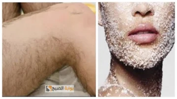 وصفة الفحم وزيت السعد لإزالة الشعر الزائد في الوجه وتقليل ظهوره نهائيا “ودعي جلسات الليزر”