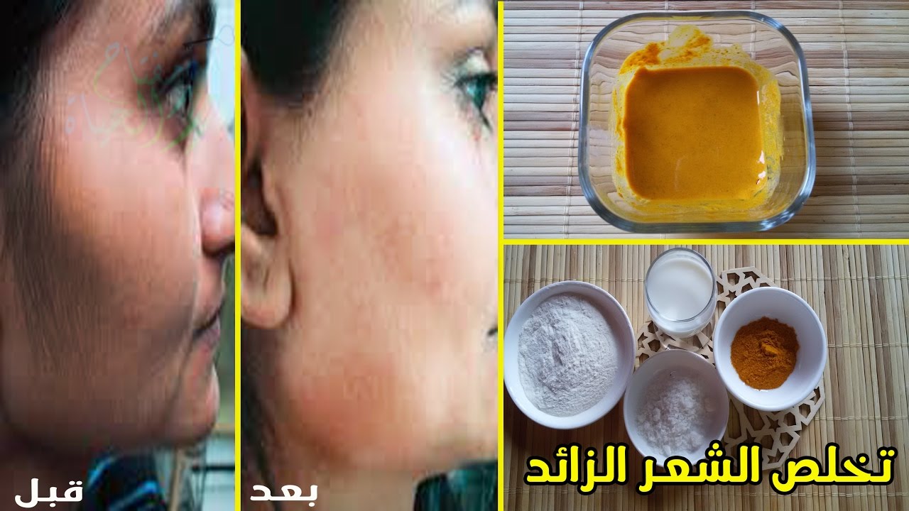 مش هتحتاجي الليزر تاني... وصفة النشا والكركم للتخلص من الشعر الزايد في غمضة عين 5 مش هتحتاجي الليزر تاني… وصفة النشا والكركم للتخلص من الشعر الزايد في غمضة عين