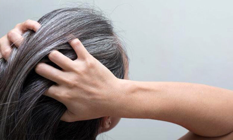 وداعاً لصبغات الشعر.. التخلص من الشعر الأبيض في يومين بمواد طبيعية
