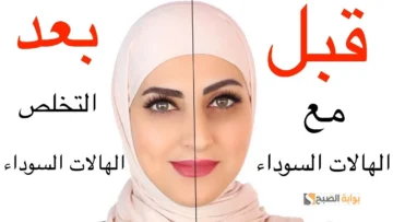 ماسكات الشاي وزيت اللوز للتخلص من الهالات الاسمرار حول العين في دقائق
