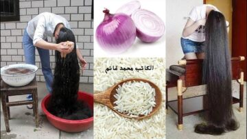 حتى لو عندك ثعلبة راسك هتنبت.. طريقة عمل قناع ماء الأرز مع البصل لتطويل وكثافة الشعر بسرعة  “ينمو كالمجنون بدون توقف”