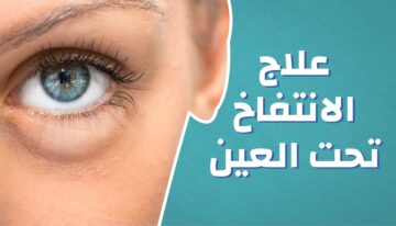 نصائح منزلية بسيطة للتخلص من انتفاخ أسفل العين.. وأبرز أسباب ظهور الانتفاخ
