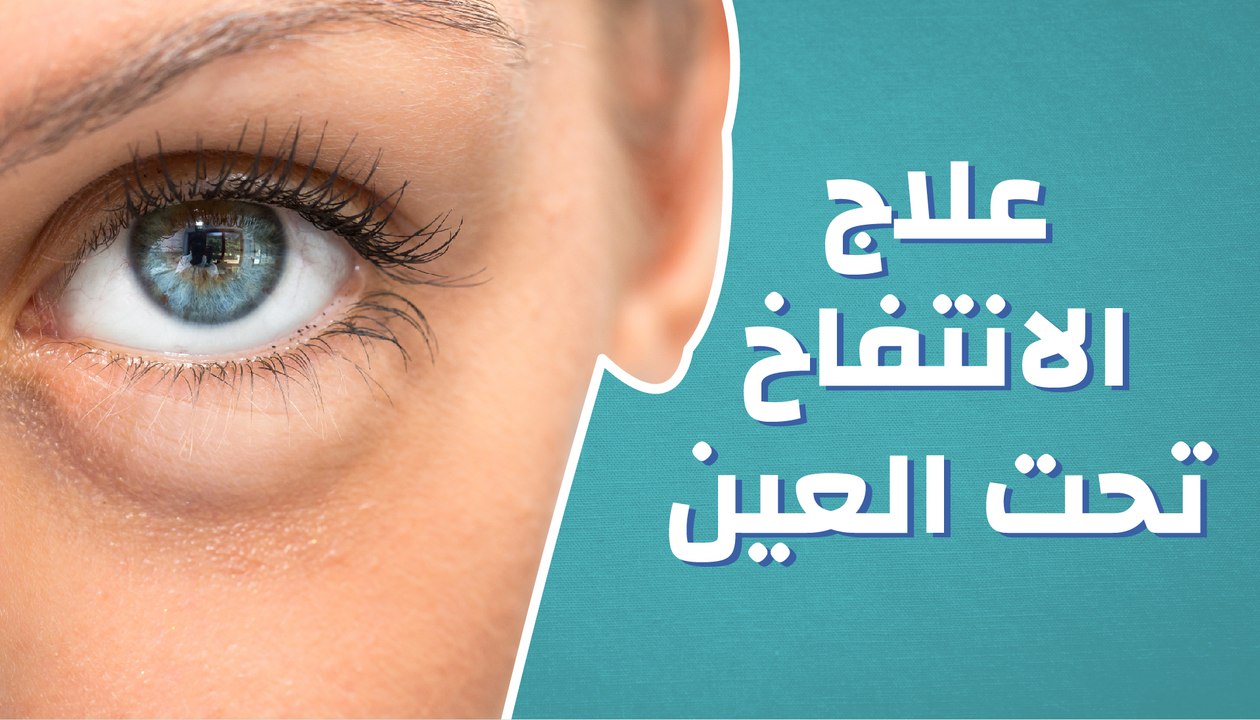 نصائح منزلية بسيطة للتخلص من انتفاخ أسفل العين.. وأبرز أسباب ظهور الانتفاخ 5 نصائح منزلية بسيطة للتخلص من انتفاخ أسفل العين.. وأبرز أسباب ظهور الانتفاخ