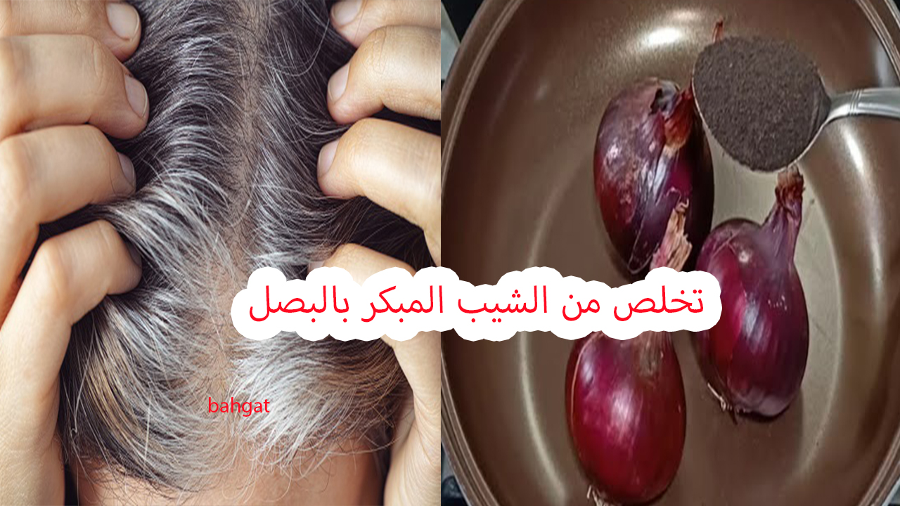 بالبصل تخلص من الشيب المبكر وتناول أطعمة تعيد لك شعرك الأسود في أسرع وقت 5 بالبصل تخلص من الشيب المبكر وتناول أطعمة تعيد لك شعرك الأسود في أسرع وقت