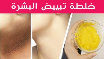 بدهنة من هذه الخلطة رقبتك هتبقي بيضة قشطة بدون سواد أو تصبغات