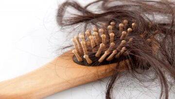 وصفات طبيعية للتخلص من تساقط الشعر بمكونات من مطبخك