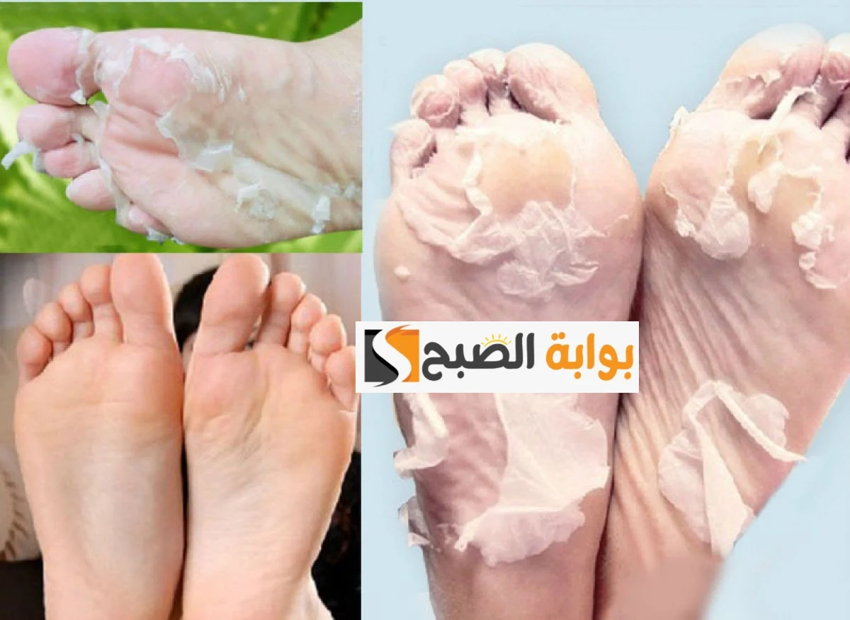 أقوى وصفة طبيعية لتنعيم اليدين والقدمين مع التفتيح السريع بخطوات بسيطة من صنع إيدك 2 أقوى وصفة طبيعية لتنعيم اليدين والقدمين مع التفتيح السريع بخطوات بسيطة من صنع إيدك