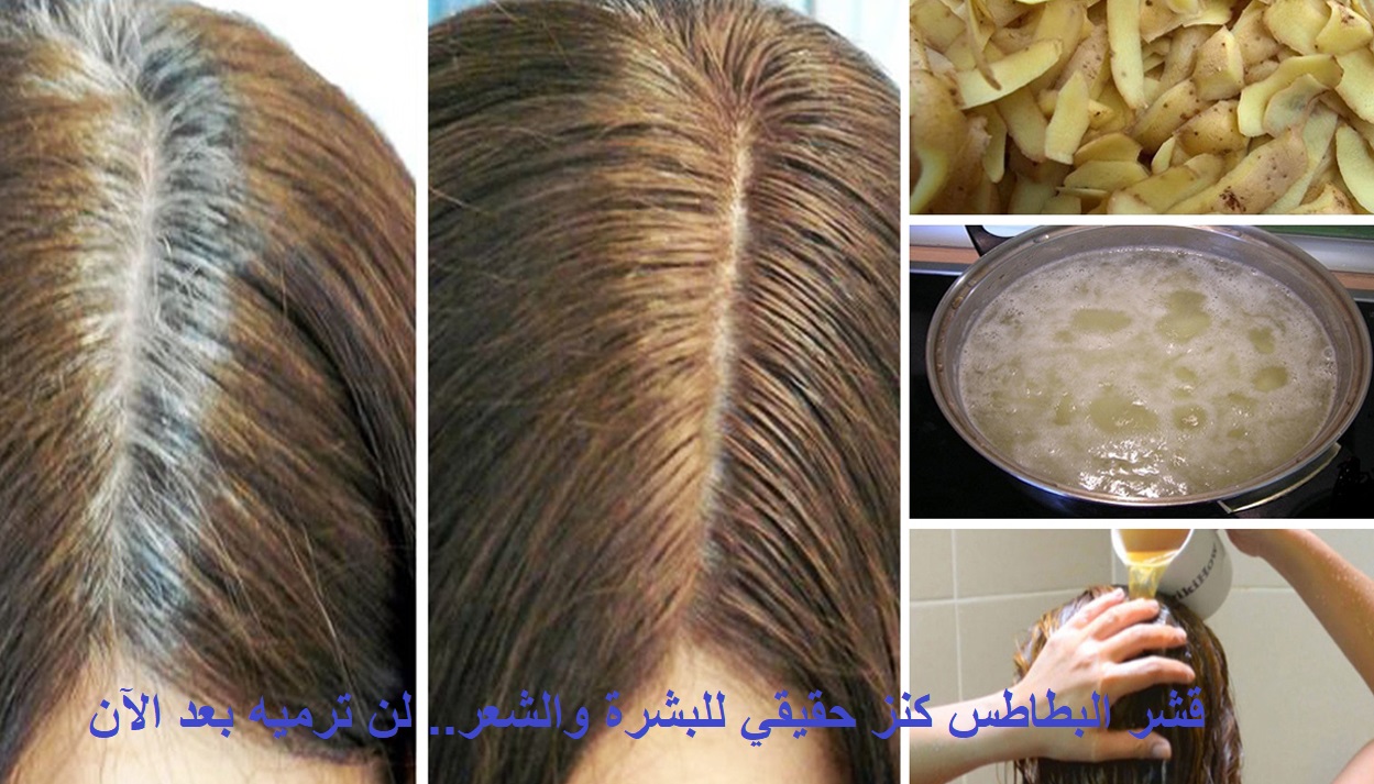 قشر البطاطس كنز حقيقي لنضارة البشرة وتكثيف وتنعيم الشعر.. لن ترميه بعد الآن! 5 قشر البطاطس كنز حقيقي لنضارة البشرة وتكثيف وتنعيم الشعر.. لن ترميه بعد الآن!