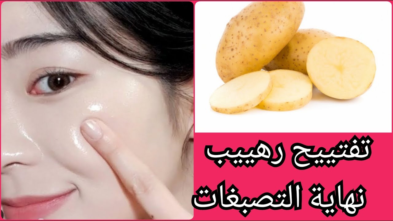 صاروخ التبيض للعروس كريم البطاطس والحليب لتفتيح البشرة وتبيضها 7 درجات والقضاء على الكلف والتصبغات لن تصدقي بياض الثلج 5 صاروخ التبيض للعروس كريم البطاطس والحليب لتفتيح البشرة وتبيضها 7 درجات والقضاء على الكلف والتصبغات لن تصدقي بياض الثلج