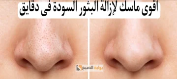 طريقة عمل ماسك من السكر وزيت الزيتون للتخلص من البثور السوداء “هتبقى أميرة يوم فرحك”