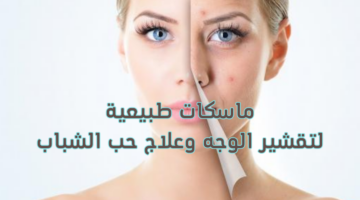 ماسكات طبيعية لتقشير الوجه وعلاج حب الشباب