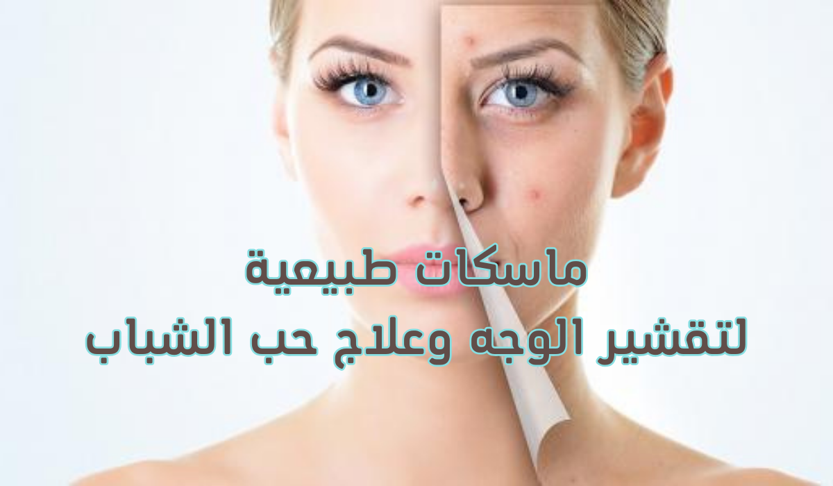 3 ماسكات طبيعية لتقشير الوجه وعلاج حب الشباب.. جربيها بنفسك وادعيلي 5 3 ماسكات طبيعية لتقشير الوجه وعلاج حب الشباب.. جربيها بنفسك وادعيلي