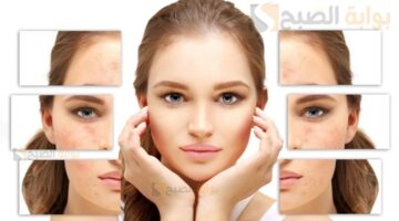 وصفات طبيعية سهلة وسريعة لتخلص من تصبغات البشرة