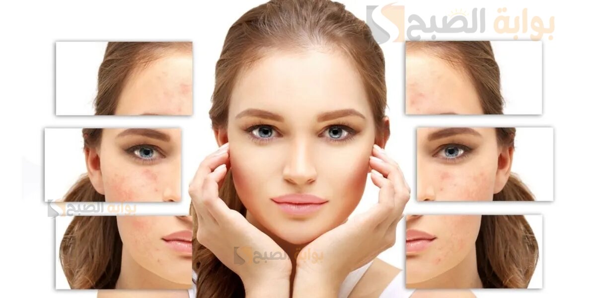 وصفات طبيعية سهلة وسريعة لتخلص من تصبغات البشرة 3 وصفات طبيعية سهلة وسريعة لتخلص من تصبغات البشرة
