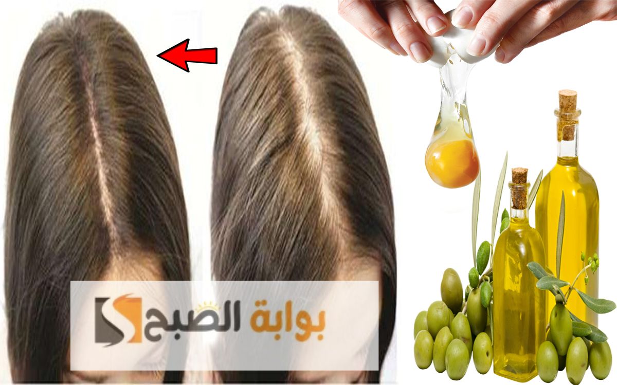 وصفة إماراتية لتطويل الشعر وإنبات مقدمة الرأس بأسرع وقت 5 وصفة إماراتية لتطويل الشعر وإنبات مقدمة الرأس بأسرع وقت
