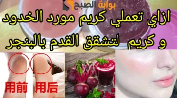 وصفة البنجر لتشققات القدمين