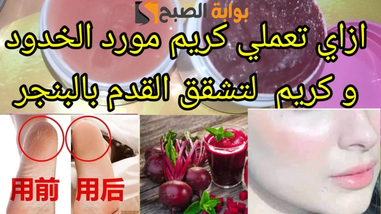 في فصل الشتاء وصفة طبيعية تخلصك من تشققات القدمين مع التنعيم "'جمالك كعب رجلك" 2 في فصل الشتاء وصفة طبيعية تخلصك من تشققات القدمين مع التنعيم “‘جمالك كعب رجلك”