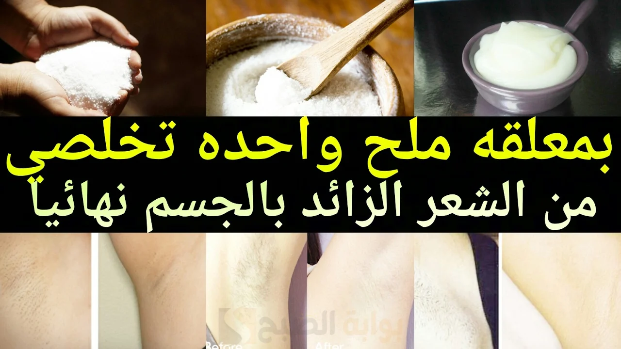 كل البنات جربتها .. وصفة الكركم والنشا لإزالة الشعر من الجسم كله في لحظات " هتبقي فلة منورة زي الشمعة" 2 كل البنات جربتها .. وصفة الكركم والنشا لإزالة الشعر من الجسم كله في لحظات ” هتبقي فلة منورة زي الشمعة”