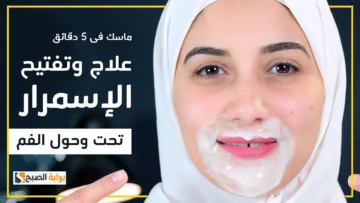 وصفة طبيعية لإزالة الاسمرار حول الفم ونصائح يجب الحرص عليها لتجنب ظهور تلك المشكلة مرة أخرى “النتيجة هتبهرك”
