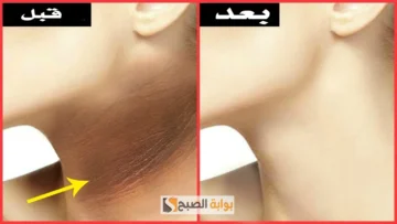 وصفة عصير البرتقال والنشا لتفتيح الرقبة وإزالة الاسمرار “هتبقى زي القشطة”