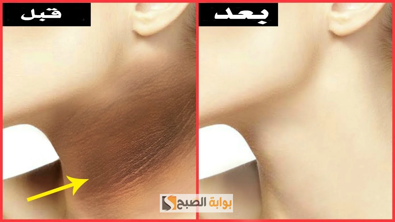 وصفة عصير البرتقال والنشا لتفتيح الرقبة وإزالة الاسمرار "هتبقى زي القشطة" 5 وصفة عصير البرتقال والنشا لتفتيح الرقبة وإزالة الاسمرار “هتبقى زي القشطة”